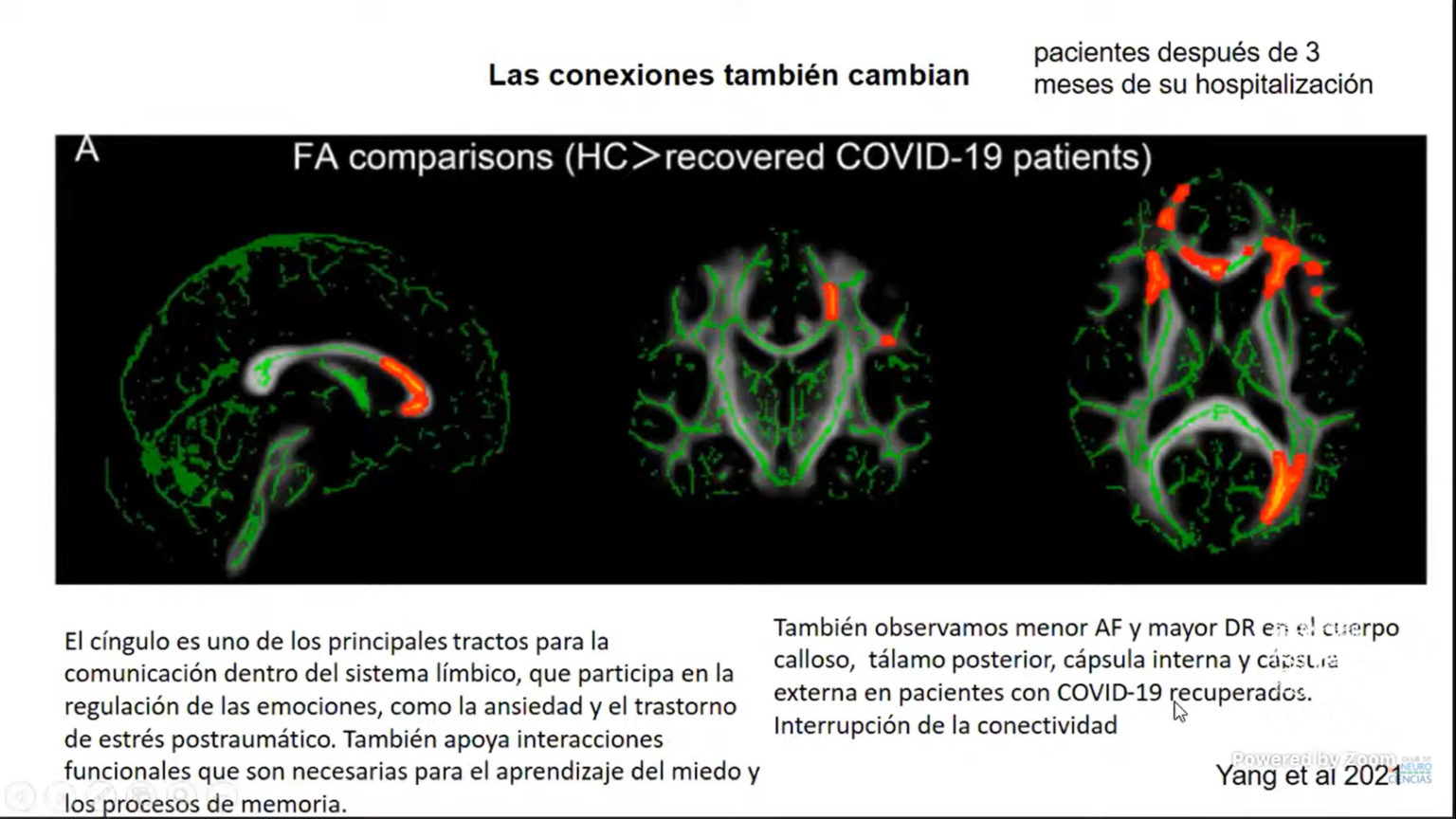 Documenta Neurociencia Afectaciones Cerebrales En Sobrevivientes De My XXX Hot Girl